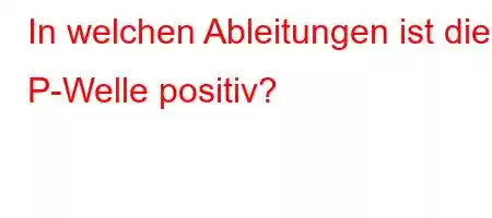 In welchen Ableitungen ist die P-Welle positiv?