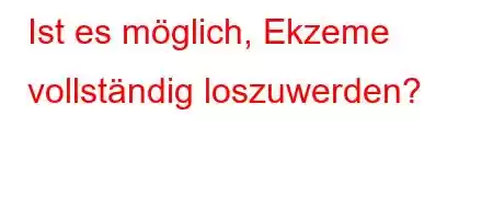 Ist es möglich, Ekzeme vollständig loszuwerden?