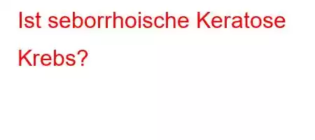 Ist seborrhoische Keratose Krebs