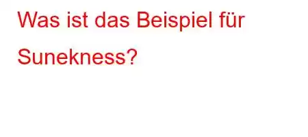 Was ist das Beispiel für Sunekness