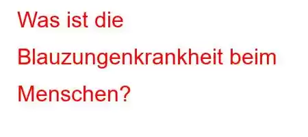 Was ist die Blauzungenkrankheit beim Menschen?