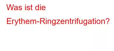 Was ist die Erythem-Ringzentrifugation