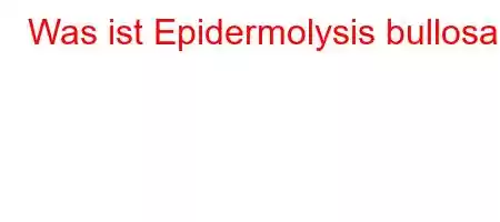 Was ist Epidermolysis bullosa