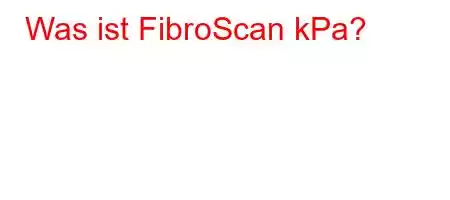 Was ist FibroScan kPa?