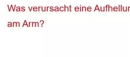 Was verursacht eine Aufhellung am Arm?