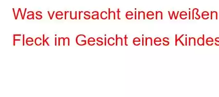 Was verursacht einen weißen Fleck im Gesicht eines Kindes?