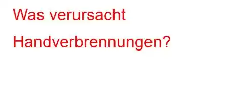 Was verursacht Handverbrennungen