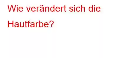 Wie verändert sich die Hautfarbe?