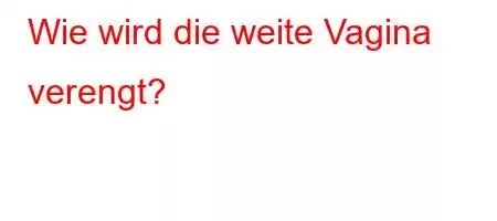 Wie wird die weite Vagina verengt?