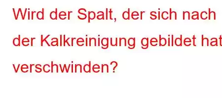 Wird der Spalt, der sich nach der Kalkreinigung gebildet hat, verschwinden